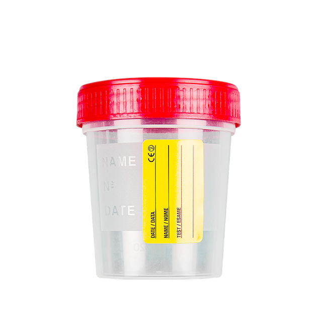 Urine containers in Ghana - GRSC Store